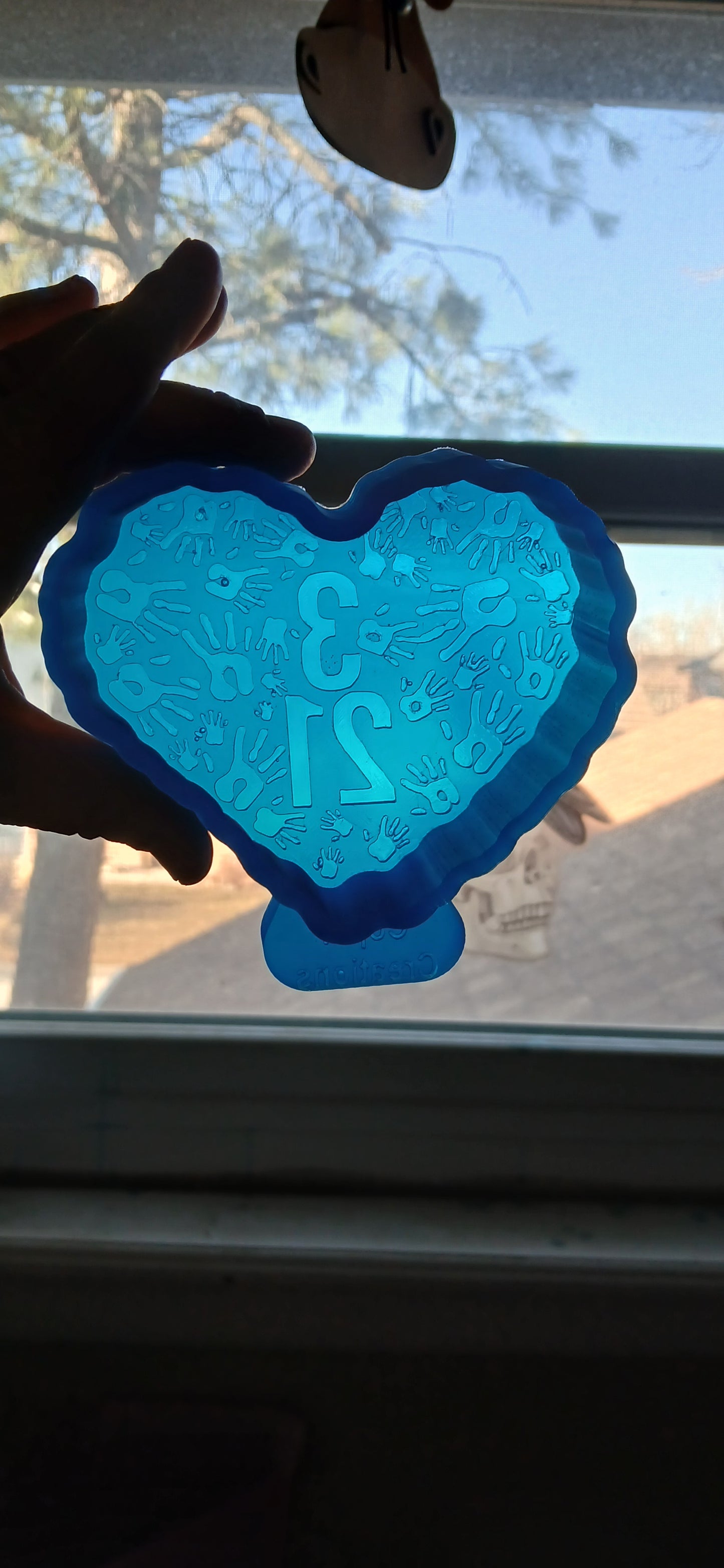 Down Syndrome Heart